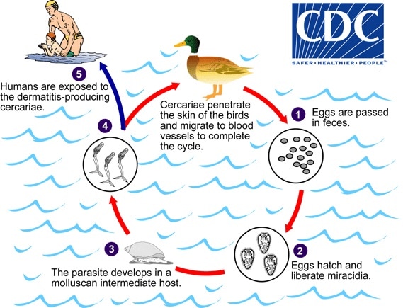 Cercarial dermatitis life cycle